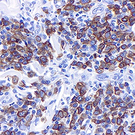 F)  Immunohistochemistry with Marker and Panel Options ($42 and $70)