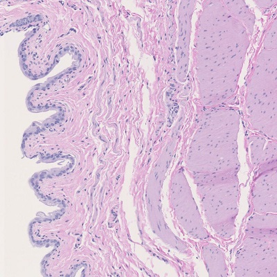 F)  Urinary Bladder Light Microscopy