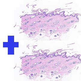 Additional Microscopic Slide Charge